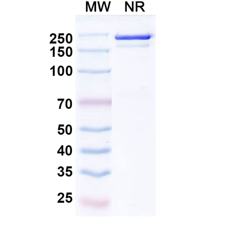 SDS-PAGE - Vilamakitug Biosimilar - Anti-IL-1 alpha Antibody - BSA and Azide free (A339812) - Antibodies.com