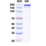 SDS-PAGE - Vilamakitug Biosimilar - Anti-IL-1 alpha Antibody - BSA and Azide free (A339812) - Antibodies.com