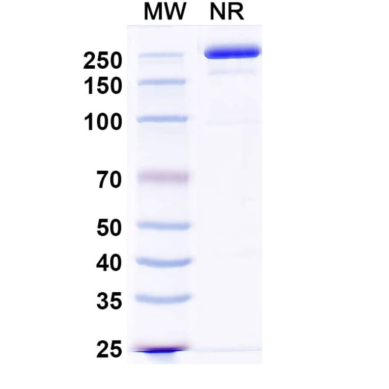 SDS-PAGE - Zigakibart Biosimilar - Anti-TNFSF13 Antibody - BSA and Azide free (A339816) - Antibodies.com
