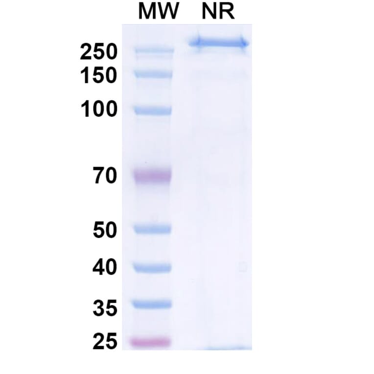 SDS-PAGE - Zigakibart Biosimilar - Anti-TNFSF13 Antibody - BSA and Azide free (A339816) - Antibodies.com