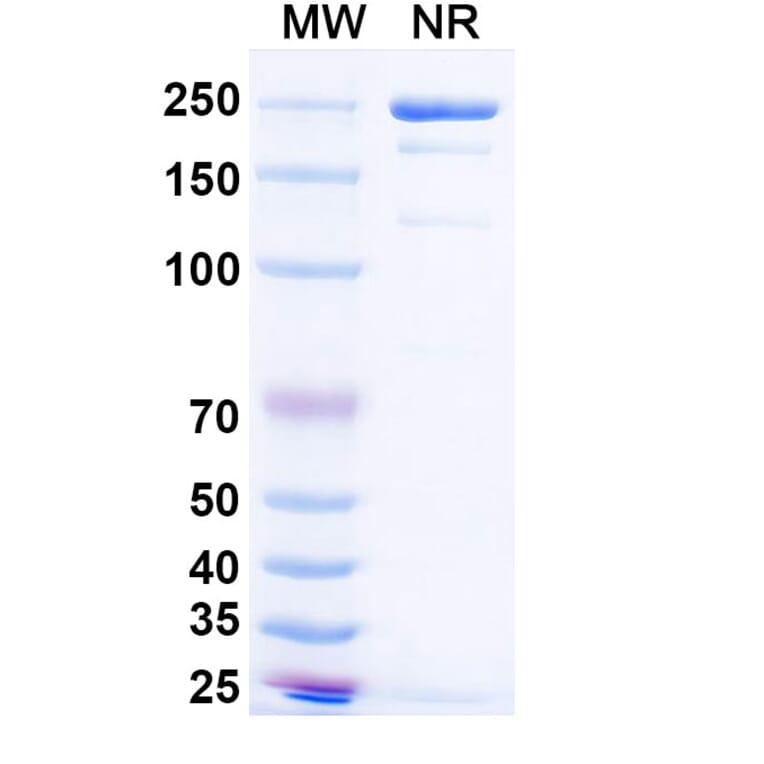 SDS-PAGE - Simaravibart Biosimilar - Anti-SARS-CoV-2 Spike Protein RBD Antibody - BSA and Azide free (A339817) - Antibodies.com