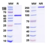 SDS-PAGE - Trastuzumab Biosimilar - Anti-ErbB2 Antibody - BSA and Azide free (A339823) - Antibodies.com