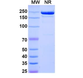 SDS-PAGE - Camidanlumab Biosimilar - Anti-CD25 Antibody - BSA and Azide free (A339826) - Antibodies.com