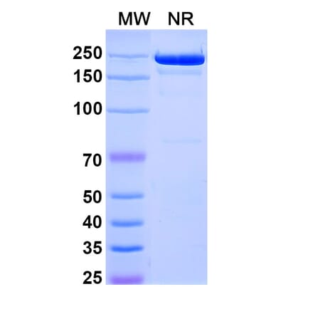 SDS-PAGE - Camidanlumab Biosimilar - Anti-CD25 Antibody - BSA and Azide free (A339826) - Antibodies.com