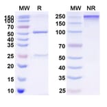 SDS-PAGE - Vibostolimab Biosimilar - Anti-TIGIT Antibody - BSA and Azide free (A339835) - Antibodies.com
