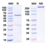 SDS-PAGE - MK-3655 Biosimilar - Anti-KLB Antibody - BSA and Azide free (A339841) - Antibodies.com