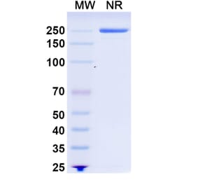 SDS-PAGE - Rituximab Biosimilar - Anti-CD20 Antibody - BSA and Azide free (A339843) - Antibodies.com
