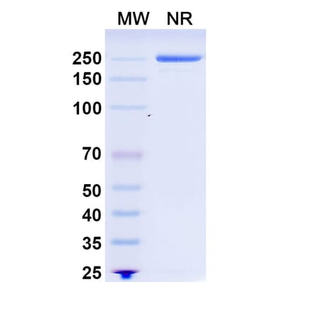 SDS-PAGE - Rituximab Biosimilar - Anti-CD20 Antibody - BSA and Azide free (A339843) - Antibodies.com