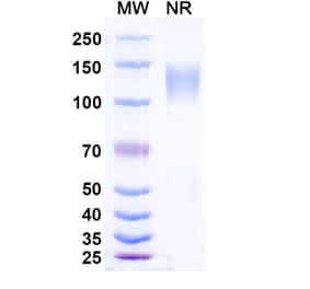 SDS-PAGE - Ramatercept Biosimilar - Anti-Myostatin Antibody - BSA and Azide free (A339856) - Antibodies.com