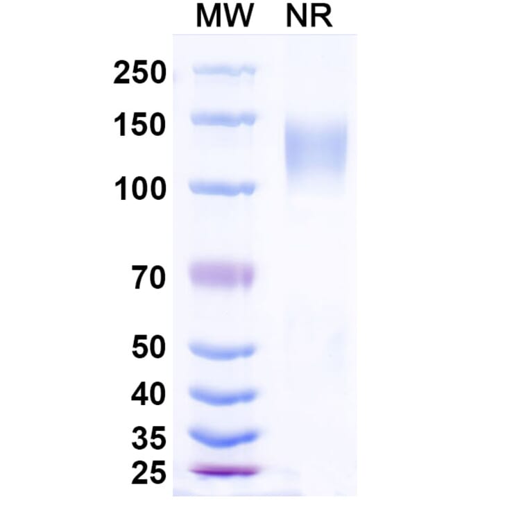 SDS-PAGE - Ramatercept Biosimilar - Anti-Myostatin Antibody - BSA and Azide free (A339856) - Antibodies.com