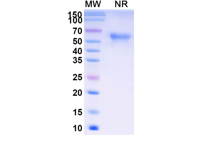 SDS-PAGE - Ramatercept Biosimilar - Anti-Myostatin Antibody - BSA and Azide free (A339856) - Antibodies.com