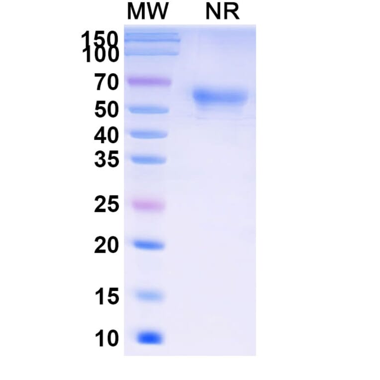 SDS-PAGE - Ramatercept Biosimilar - Anti-Myostatin Antibody - BSA and Azide free (A339856) - Antibodies.com