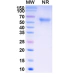SDS-PAGE - Ramatercept Biosimilar - Anti-Myostatin Antibody - BSA and Azide free (A339856) - Antibodies.com