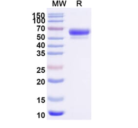 SDS-PAGE - Sotatercept Biosimilar - Anti-Inhibin beta A Antibody - BSA and Azide free (A339857) - Antibodies.com