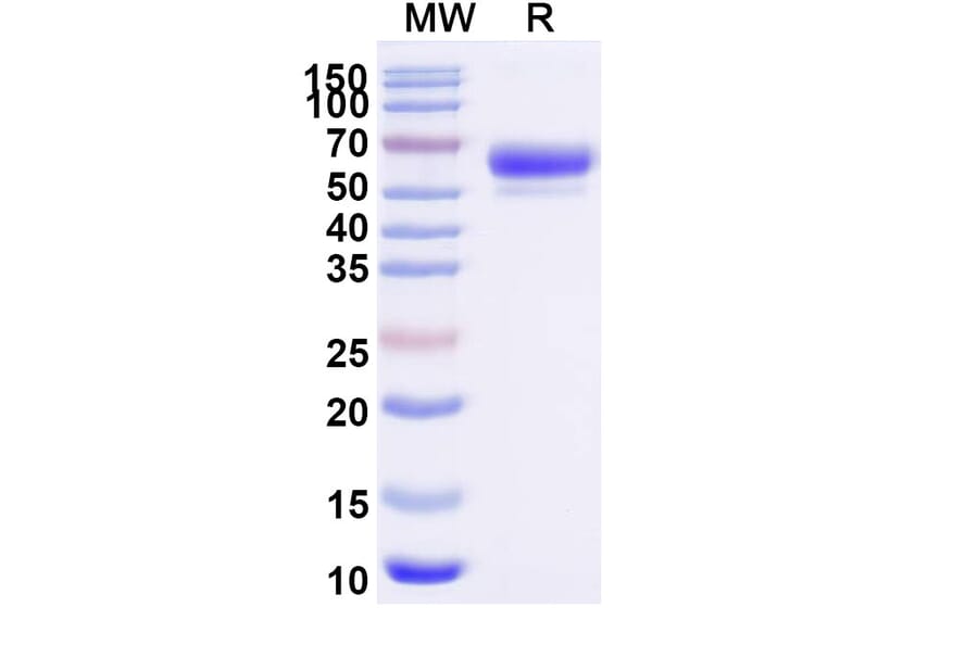 SDS-PAGE - Sotatercept Biosimilar - Anti-Inhibin beta A Antibody - BSA and Azide free (A339857) - Antibodies.com