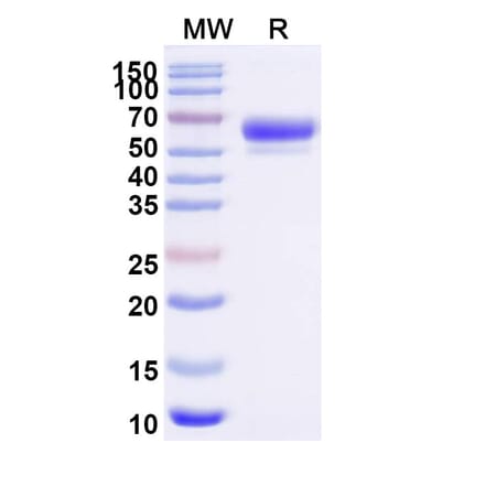 SDS-PAGE - Sotatercept Biosimilar - Anti-Inhibin beta A Antibody - BSA and Azide free (A339857) - Antibodies.com