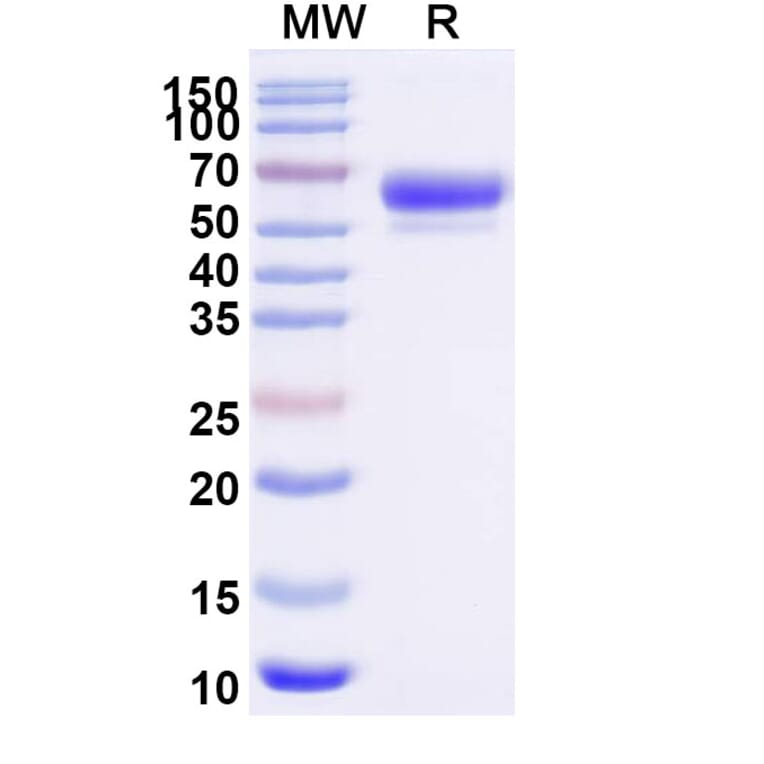 SDS-PAGE - Sotatercept Biosimilar - Anti-Inhibin beta A Antibody - BSA and Azide free (A339857) - Antibodies.com