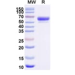 SDS-PAGE - Sotatercept Biosimilar - Anti-Inhibin beta A Antibody - BSA and Azide free (A339857) - Antibodies.com