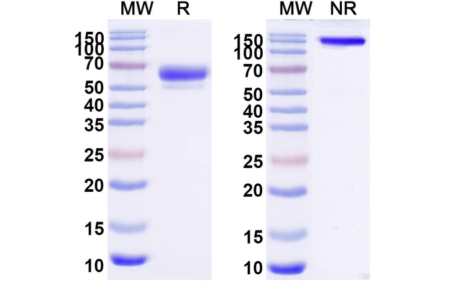 SDS-PAGE - Sotatercept Biosimilar - Anti-Inhibin beta A Antibody - BSA and Azide free (A339857) - Antibodies.com