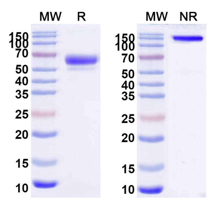 SDS-PAGE - Sotatercept Biosimilar - Anti-Inhibin beta A Antibody - BSA and Azide free (A339857) - Antibodies.com
