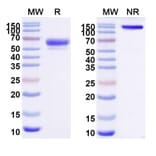 SDS-PAGE - Sotatercept Biosimilar - Anti-Inhibin beta A Antibody - BSA and Azide free (A339857) - Antibodies.com