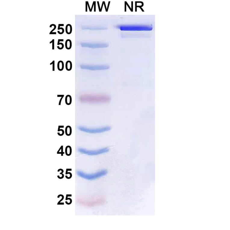 SDS-PAGE - Boserolimab Biosimilar - Anti-CD27 Antibody - BSA and Azide free (A339859) - Antibodies.com