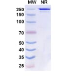SDS-PAGE - Boserolimab Biosimilar - Anti-CD27 Antibody - BSA and Azide free (A339859) - Antibodies.com