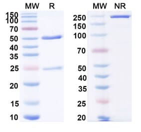 SDS-PAGE - Anti-IL-18 Antibody [ABT-325] Biosimilar - BSA and Azide free (A339860) - Antibodies.com