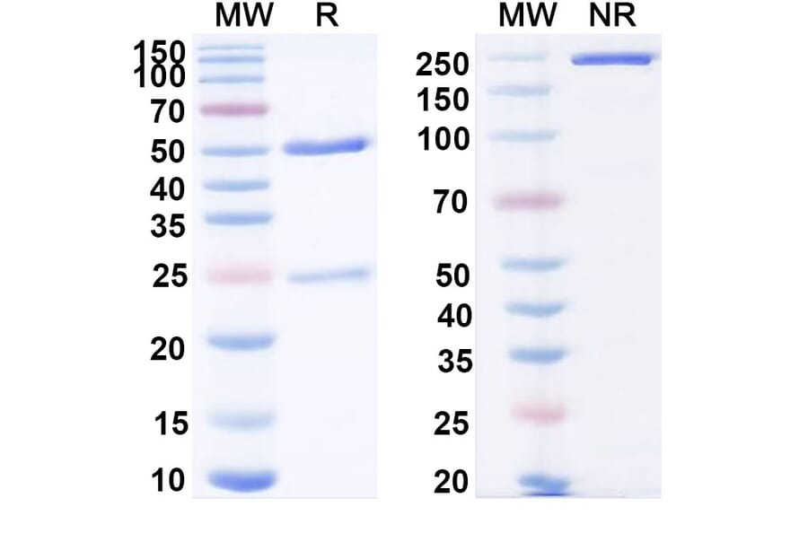 SDS-PAGE - Anti-IL-18 Antibody [ABT-325] Biosimilar - BSA and Azide free (A339860) - Antibodies.com