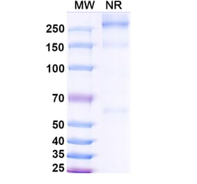 SDS-PAGE - Asfotase alfa Biosimilar - Anti-ALPL Antibody - BSA and Azide free (A339869) - Antibodies.com