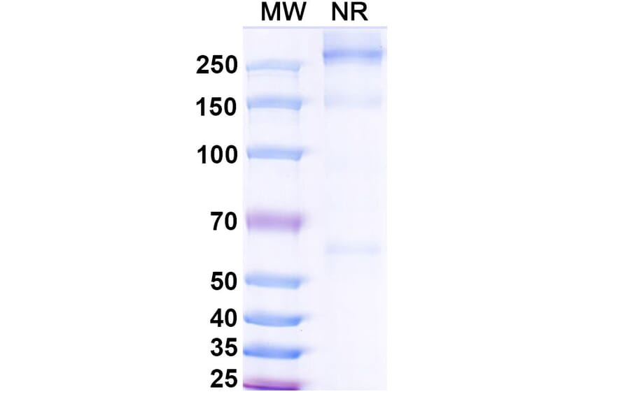 SDS-PAGE - Asfotase alfa Biosimilar - Anti-ALPL Antibody - BSA and Azide free (A339869) - Antibodies.com