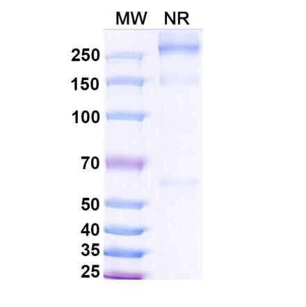 SDS-PAGE - Asfotase alfa Biosimilar - Anti-ALPL Antibody - BSA and Azide free (A339869) - Antibodies.com