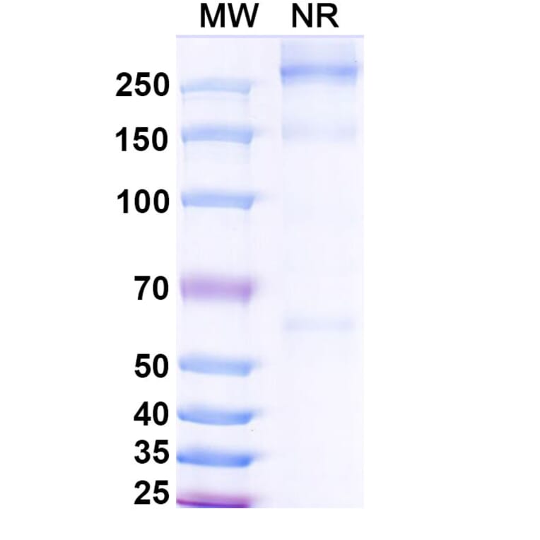 SDS-PAGE - Asfotase alfa Biosimilar - Anti-ALPL Antibody - BSA and Azide free (A339869) - Antibodies.com