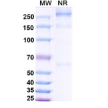 SDS-PAGE - Asfotase alfa Biosimilar - Anti-ALPL Antibody - BSA and Azide free (A339869) - Antibodies.com