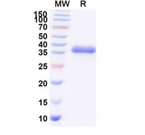SDS-PAGE - Blisibimod Biosimilar - Anti-BAFF Antibody - BSA and Azide free (A339871) - Antibodies.com