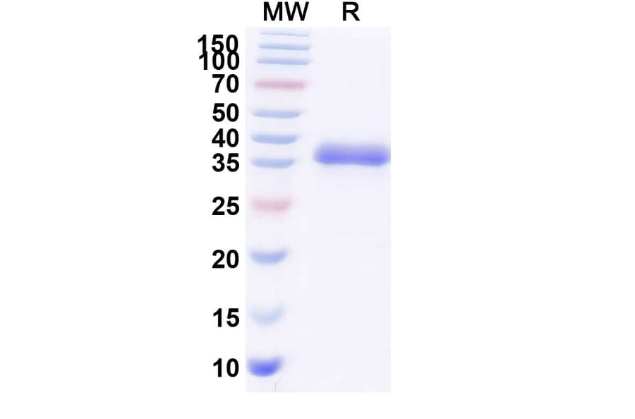 SDS-PAGE - Blisibimod Biosimilar - Anti-BAFF Antibody - BSA and Azide free (A339871) - Antibodies.com