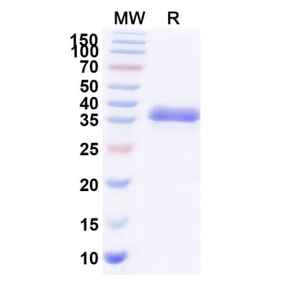 SDS-PAGE - Blisibimod Biosimilar - Anti-BAFF Antibody - BSA and Azide free (A339871) - Antibodies.com