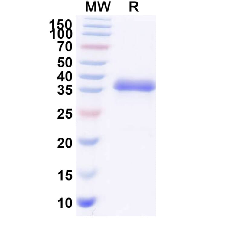 SDS-PAGE - Blisibimod Biosimilar - Anti-BAFF Antibody - BSA and Azide free (A339871) - Antibodies.com