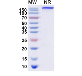 SDS-PAGE - Trebananib Biosimilar - Anti-Angiopoietin 2 Antibody - BSA and Azide free (A339873) - Antibodies.com