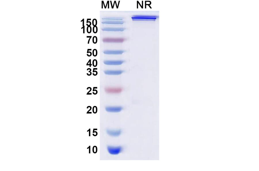 SDS-PAGE - Trebananib Biosimilar - Anti-Angiopoietin 2 Antibody - BSA and Azide free (A339873) - Antibodies.com