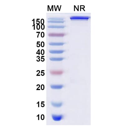 SDS-PAGE - Trebananib Biosimilar - Anti-Angiopoietin 2 Antibody - BSA and Azide free (A339873) - Antibodies.com