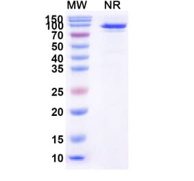 SDS-PAGE - Taldefgrobep alfa Biosimilar - Anti-Myostatin Antibody - BSA and Azide free (A339875) - Antibodies.com