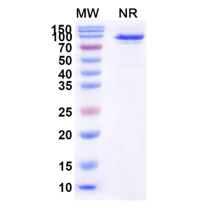 SDS-PAGE - Taldefgrobep alfa Biosimilar - Anti-Myostatin Antibody - BSA and Azide free (A339875) - Antibodies.com