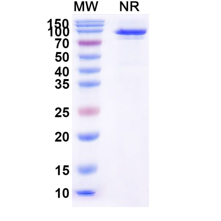 SDS-PAGE - Taldefgrobep alfa Biosimilar - Anti-Myostatin Antibody - BSA and Azide free (A339875) - Antibodies.com