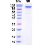 SDS-PAGE - Taldefgrobep alfa Biosimilar - Anti-Myostatin Antibody - BSA and Azide free (A339875) - Antibodies.com