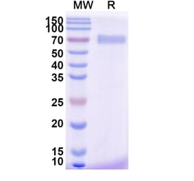 SDS-PAGE - Efmitermant alfa Biosimilar - Anti-Myostatin Antibody - BSA and Azide free (A339876) - Antibodies.com