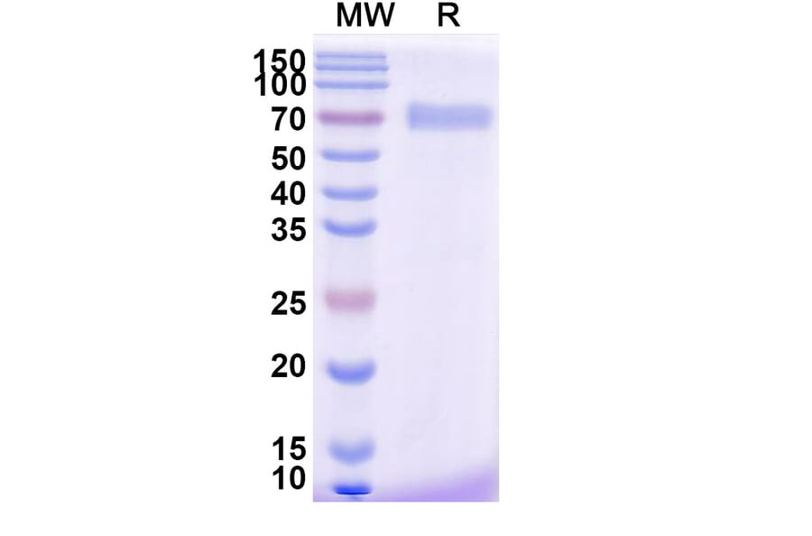 SDS-PAGE - Efmitermant alfa Biosimilar - Anti-Myostatin Antibody - BSA and Azide free (A339876) - Antibodies.com