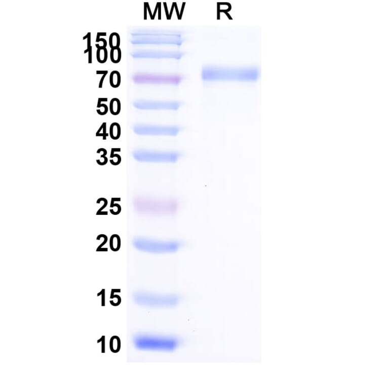 SDS-PAGE - Efmitermant alfa Biosimilar - Anti-Myostatin Antibody - BSA and Azide free (A339876) - Antibodies.com