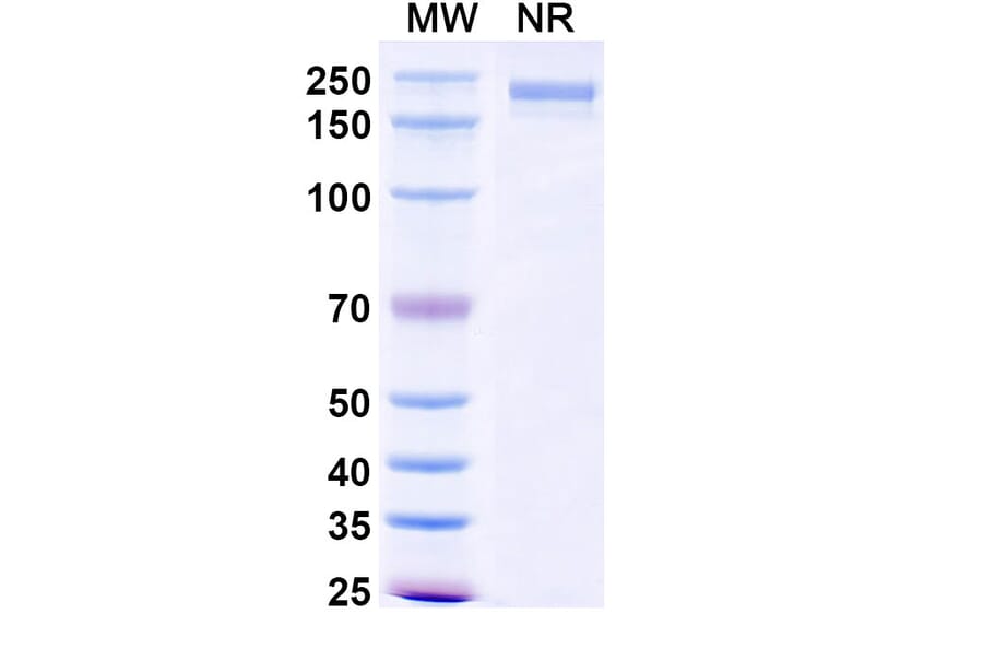 SDS-PAGE - XMT-1660 Biosimilar - Anti-B7-H4 Antibody - BSA and Azide free (A339879) - Antibodies.com