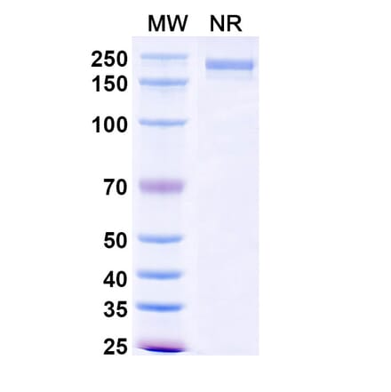 SDS-PAGE - XMT-1660 Biosimilar - Anti-B7-H4 Antibody - BSA and Azide free (A339879) - Antibodies.com